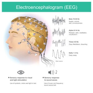 Frequenzband Neurofeedback