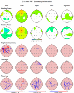 QEEG Brainmapping in Northeim