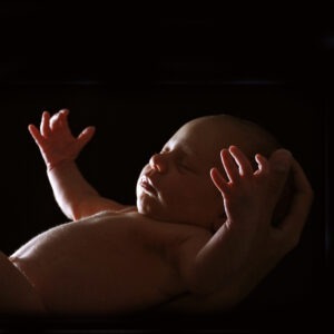 Moro Reflex